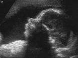 Pränataldiagnostik/ Ultraschall Pränataldiagnostik/ Ultraschall